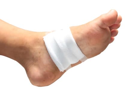 Limb Loss and Foot Ulcers