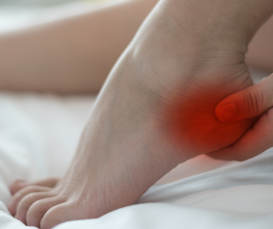 foot with heel pain from plantar fasciitis