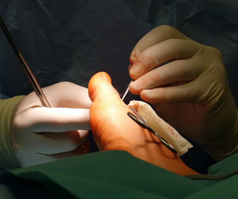 doctors performing foot surgery